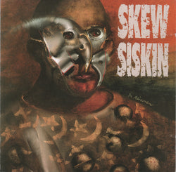Skew Siskin